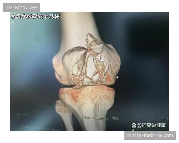 勇士官方确认柯瑞退出全明星 右膝髌骨疼痛康复慢于预期